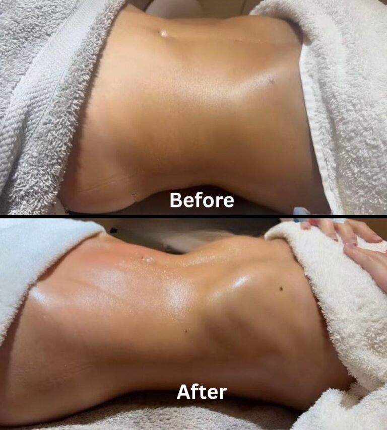 Experience professional Lymphatic Drainage Massage in Dubai with certified therapists. Same-day recovery care, detox, and 24/7 home visit services tailored for wellness and post-surgery healing.