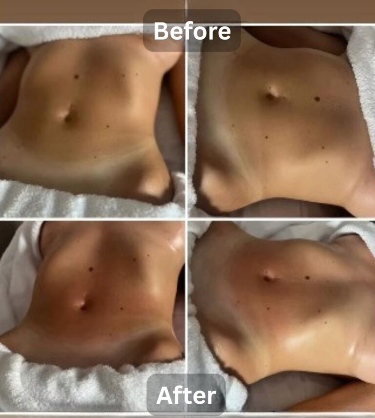 Experience professional Lymphatic Drainage Massage in Dubai with certified therapists. Same-day recovery care, detox, and 24/7 home visit services tailored for wellness and post-surgery healing.